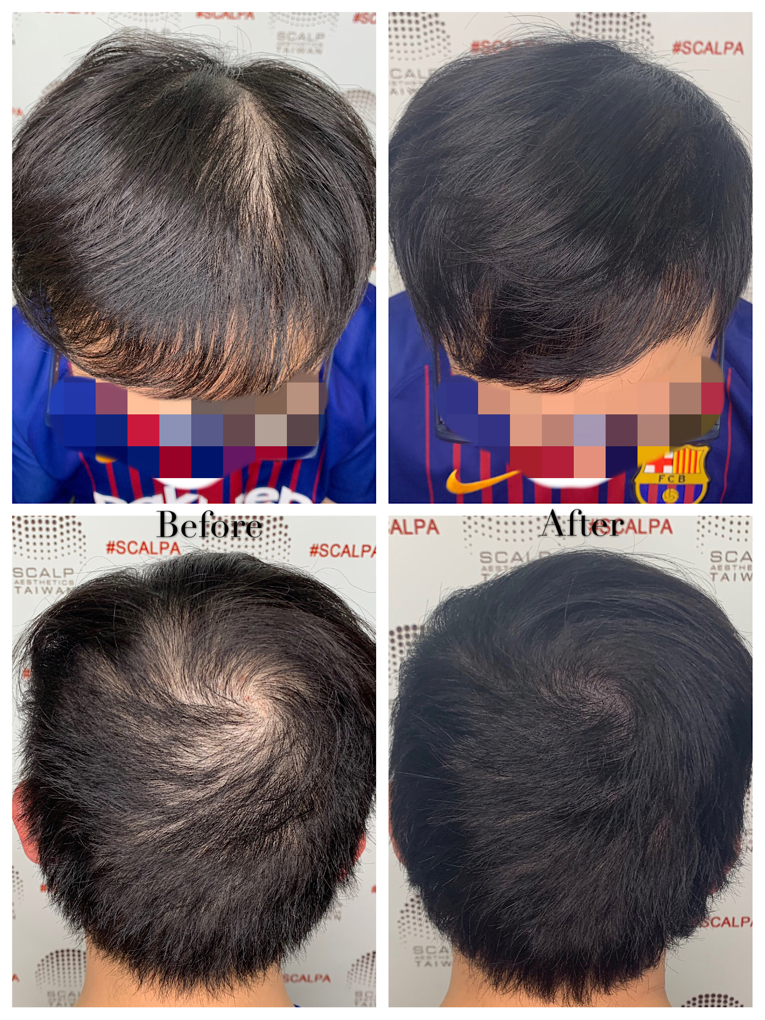 點藝頭皮美學 Scalp Aesthetics Taiwan - 中長髮作品集